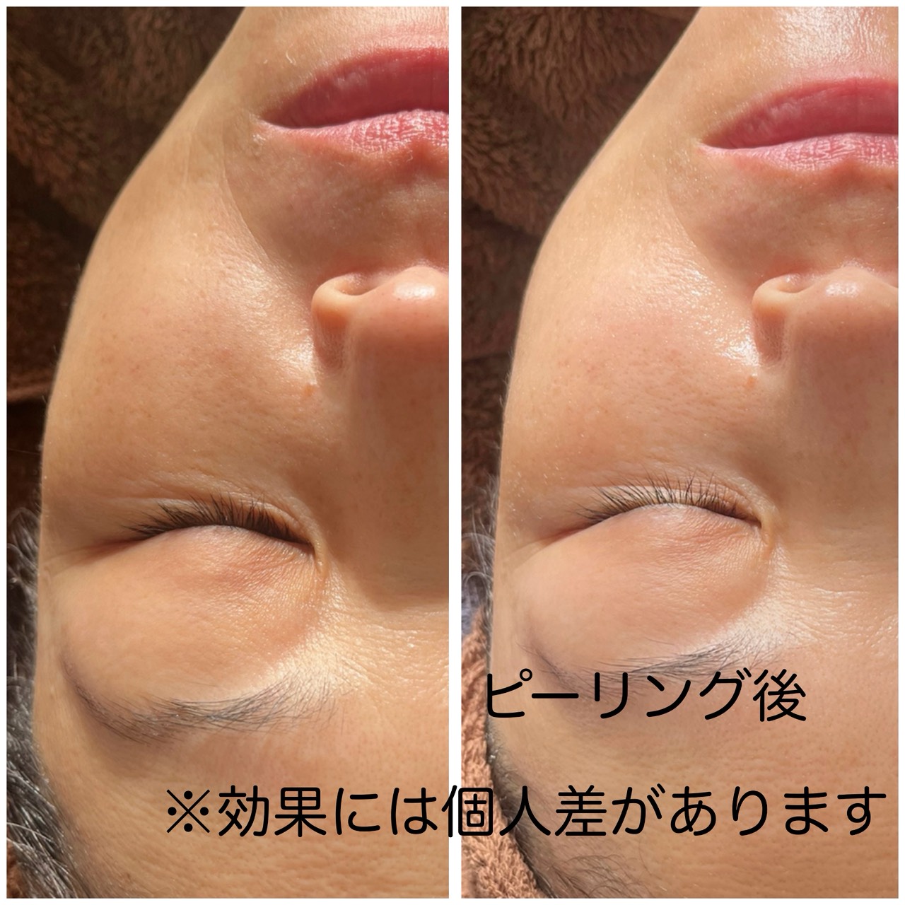 ビフォーアフター